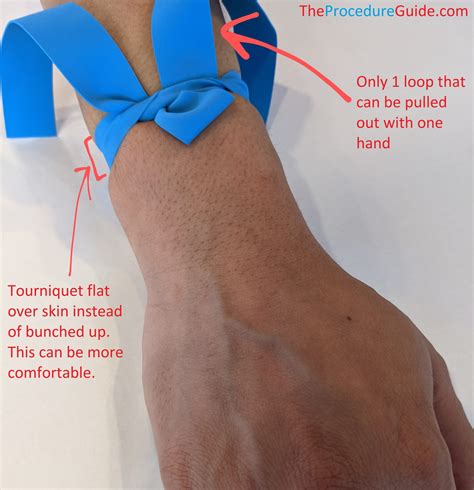 iv insertion false arm